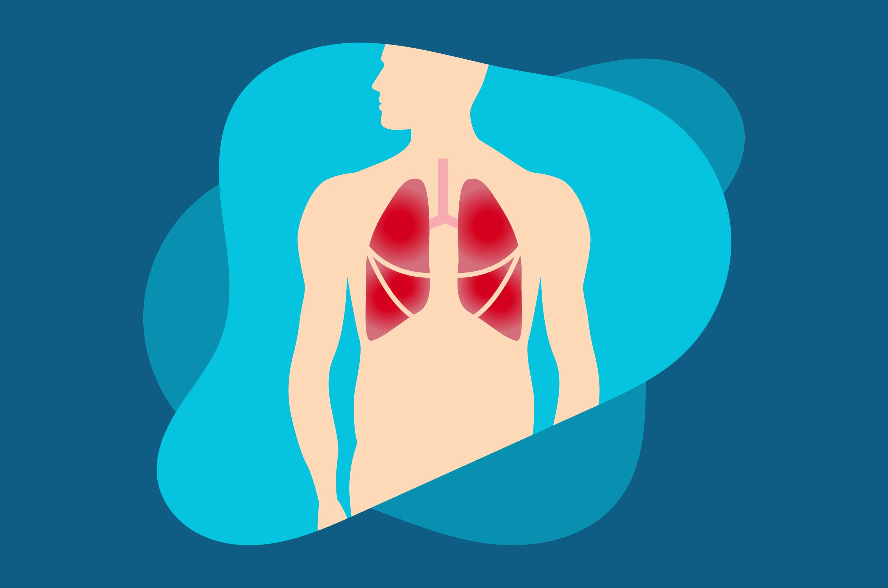 Tempat Pengobatan Pneumonia di Jakarta Terbaik dan Paling Manjur