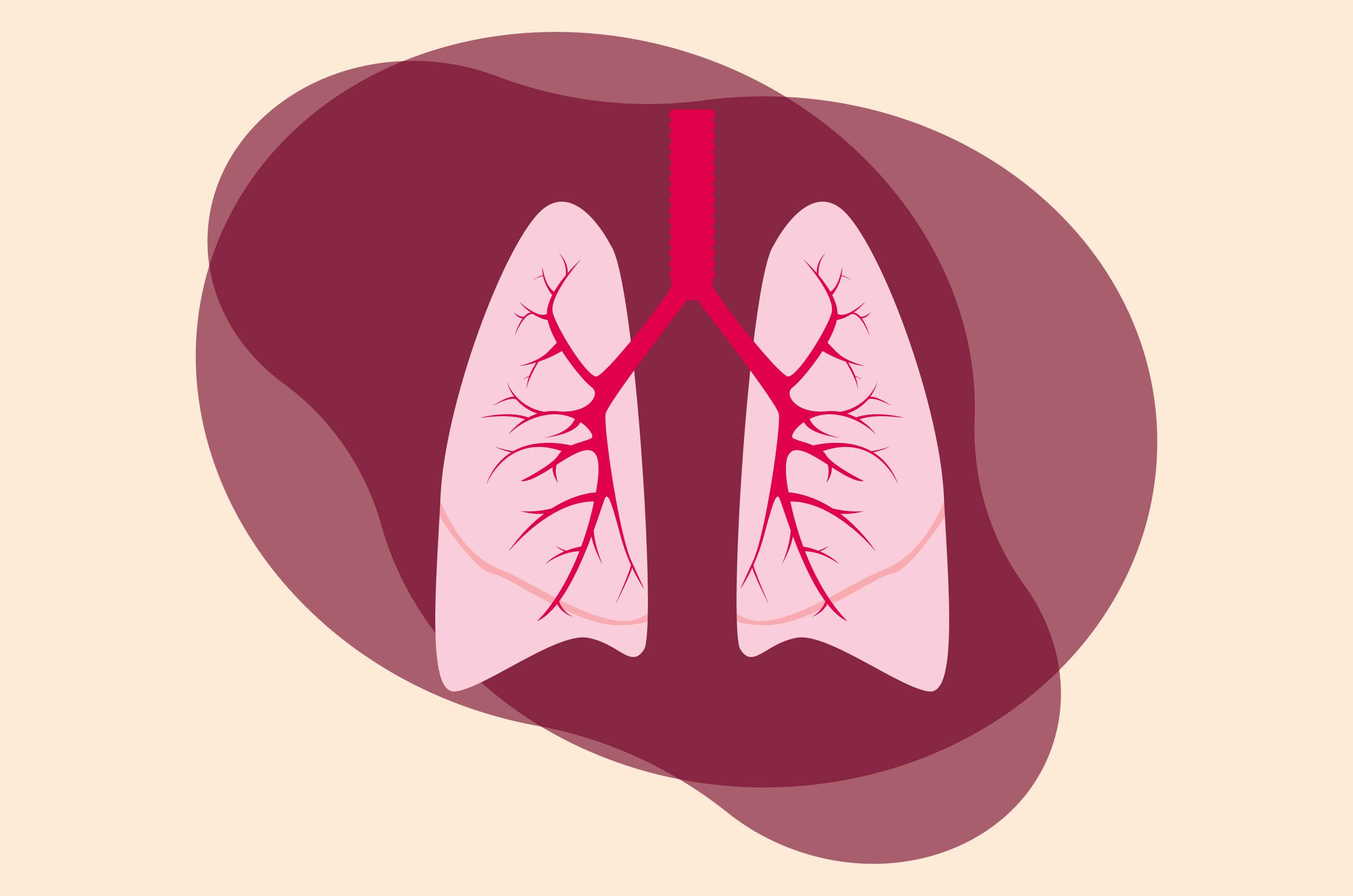 Tempat Pengobatan Pneumonia di Tangerang Paling Dicari Karena Mujarab