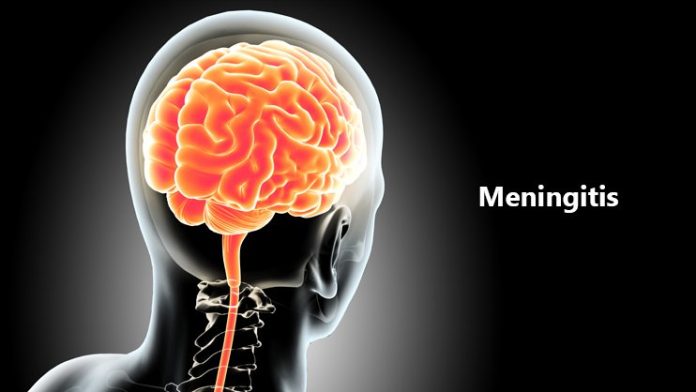 Tempat Pengobatan Infeksi Meningitis di Bintaro Profesional