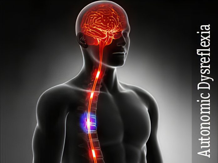 Apa itu Autonom Dysreflexia (AD)?