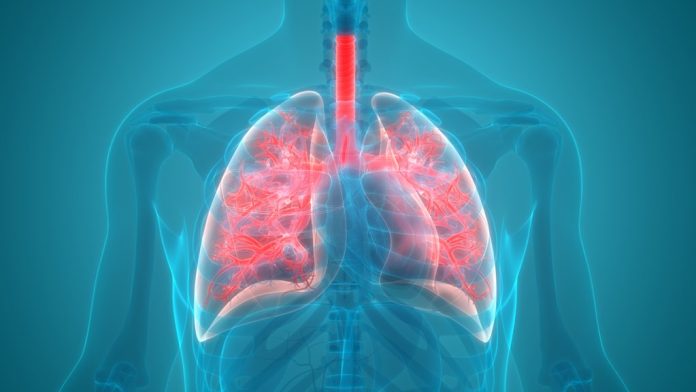 Mitos dan Fakta Penyakit Radang Paru-Paru (Pneumonia / Pneumokokus)