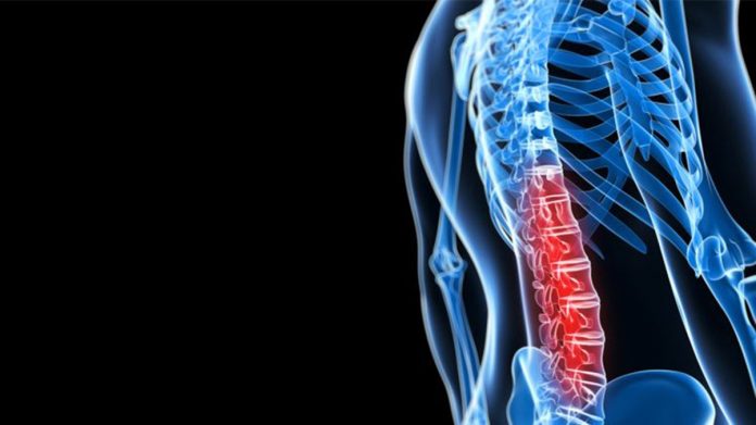 Tempat Pengobatan Autonom Dysreflexia (AD) di Cibitung Tanpa Efek Samping
