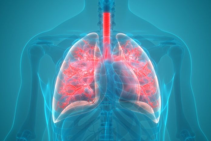 Tempat Pengobatan Pneumonia di Cikarang Paling Aman dan Nyaman