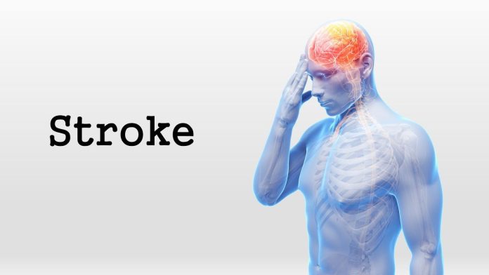 Tempat Pengobatan Stroke di Cikarang Paling Nyaman
