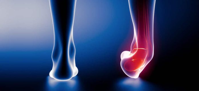 Terapi Keseleo Tulang di Cikarang Paling Nyaman dan Cepat Sembuh
