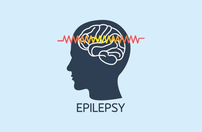 Tempat Pengobatan Epilepsi di Bangkinang Terpercaya