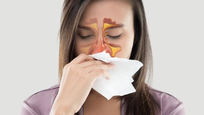 Tempat Pengobatan Sinusitis di Cibitung Paling Direkomendasikan