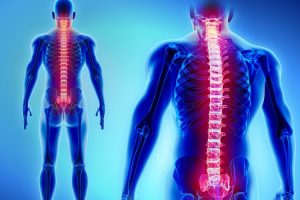 kanker tulang medical hacking