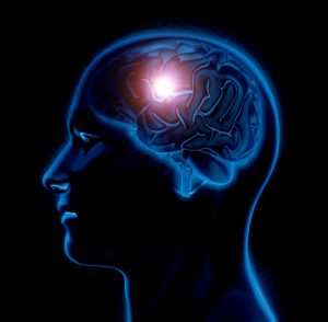  Alzheimer adalah kondisi penyakit neurodegeneratif yang dicirikan oleh penumpukan protein yang tidak normal, membentuk plak dan simpul di otak. Hal ini menyebabkan kerusakan pada sel-sel otak dan mengakibatkan penurunan fungsi kognitif secara bertahap, termasuk kemunduran dalam ingatan, pemikiran, dan kemampuan berbicara. Proses glikasi, di mana gula merusak protein, juga diyakini memainkan peran dalam perkembangan Alzheimer. Penyakit ini umumnya mempengaruhi populasi lanjut usia dan merupakan salah satu penyebab utama masalah kognitif pada usia lanjut.